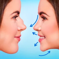 Rhinoplasty App: Nose Editor